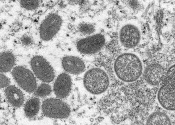 Santé: Des cas de variole du singe détectés en Europe et en Amérique du Nord 