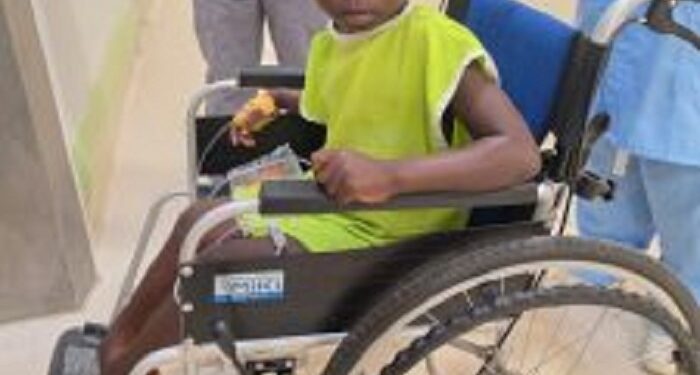 Côte d’Ivoire : Plusieurs enfants opérés gratuitement grâce à Shriners Hospitals for Children